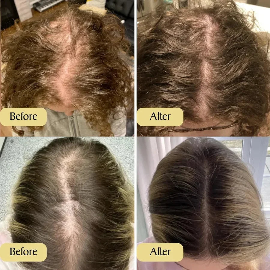 [NEW] Scalp Serum | Korean Hair Care